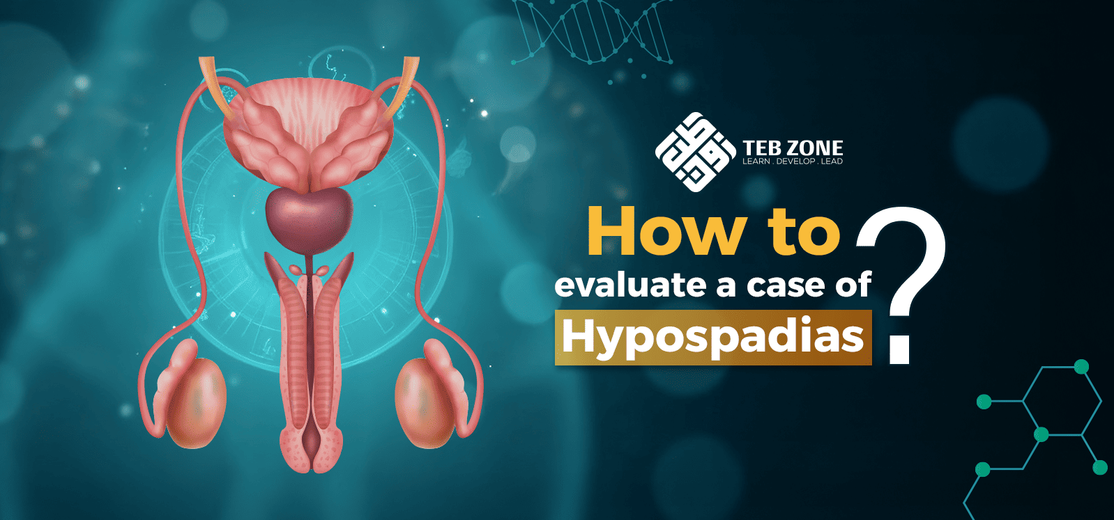 How to evaluate a case of hypospadias?